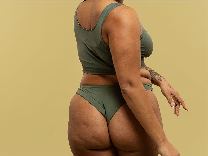 A imagem mostra uma mulher negra, de costas, vestindo uma roupa intima verde escuro, mostrando seu corpo com celulites nos glúteos. Ela possui uma tatuagem no braço esquerdo e em sua frente, há uma parede verde claro. Seu rosto não aparece na imagem.